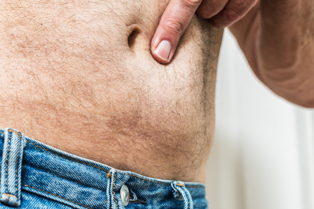 What Is the Main Cause of Hernia? Causes, Prevention & When to Seek Treatment